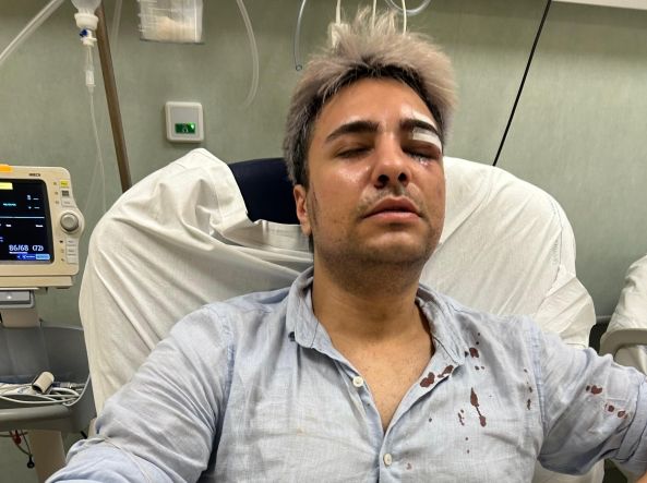 4 AGGRESSIONI OMOFOBE A ROMA IN POCHI GIORNI: IL COMUNE INTEGRI LE NOSTRE PROPOSTE NELLA DELIBERA CONTRO L’OMOBITRANSFOBIA